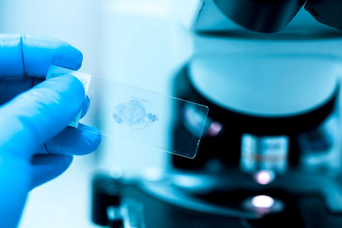 Type of diet that reduces cancer risk identified