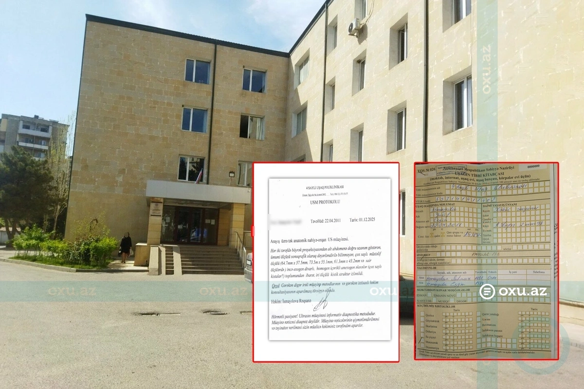 Bakıda ana və ataya uşağın səhhəti ilə bağlı fərqli arayış verən həkim CƏZALANDIRILDI