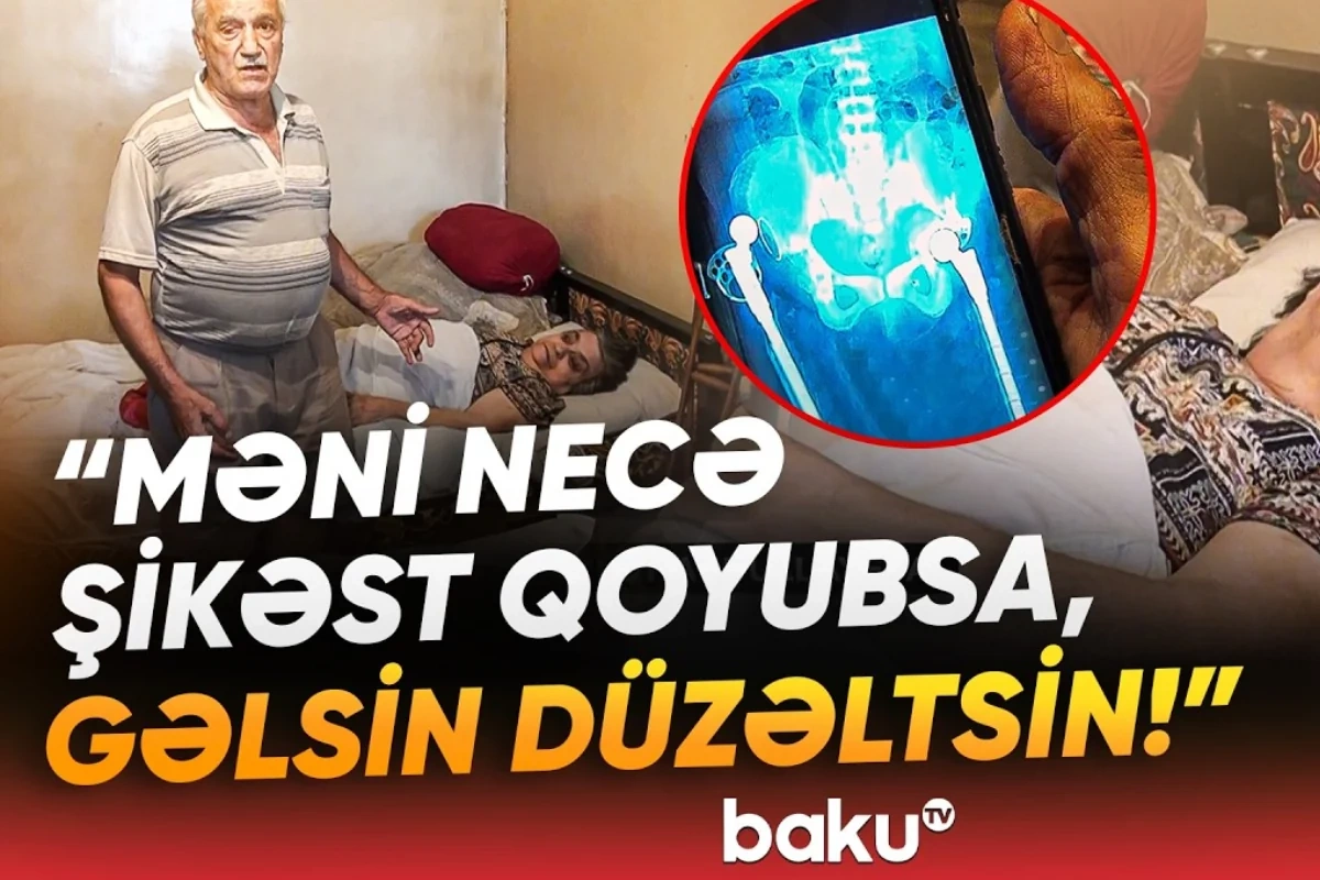 Qadının sol ayağının yerinə sağ ayağı əməliyyat edilib? - Həkim dedi ki, qayıtmayacağam