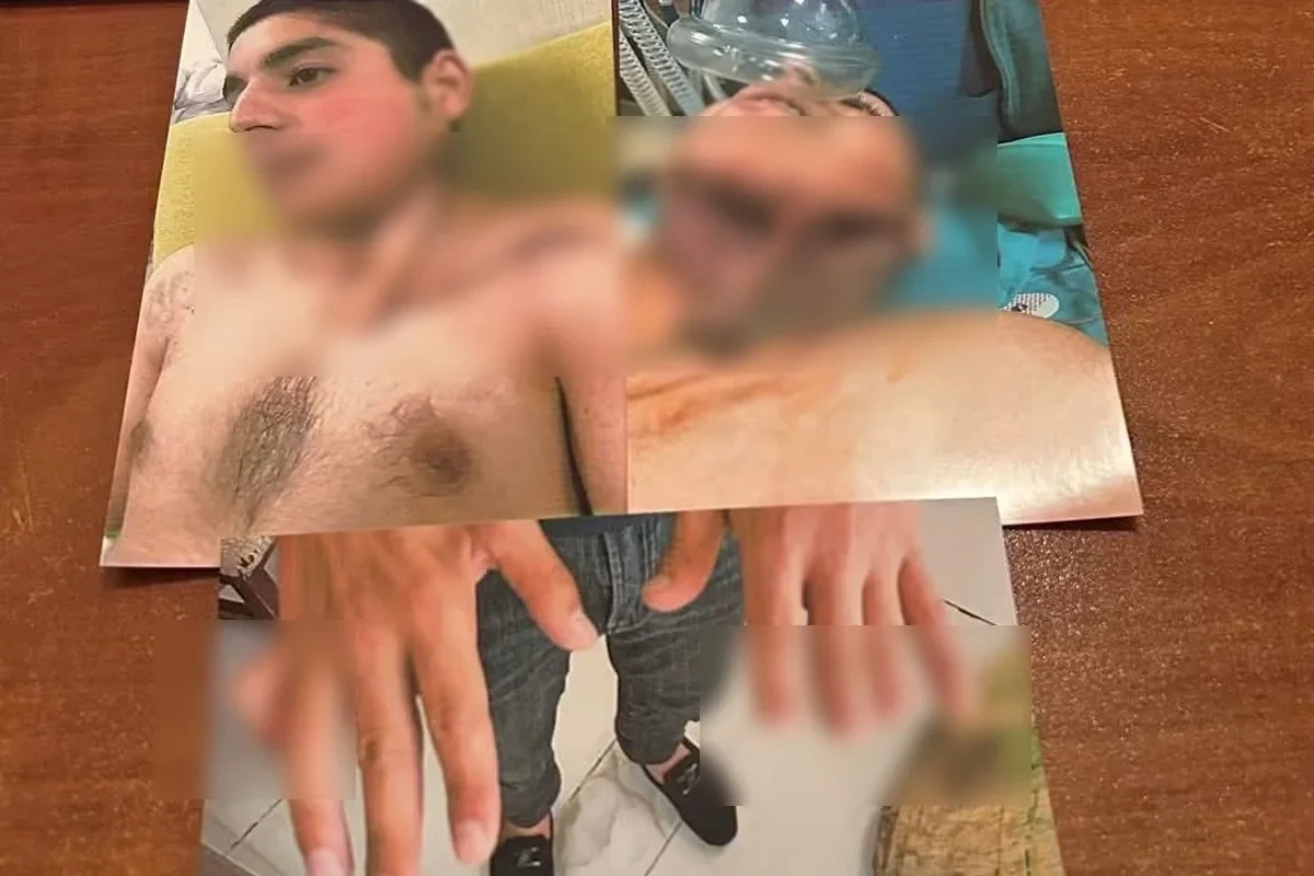Əlillik ala bilməyən qazi ilə bağlı TƏBİB-dən açıqlama: Meyarlara uyğun deyil