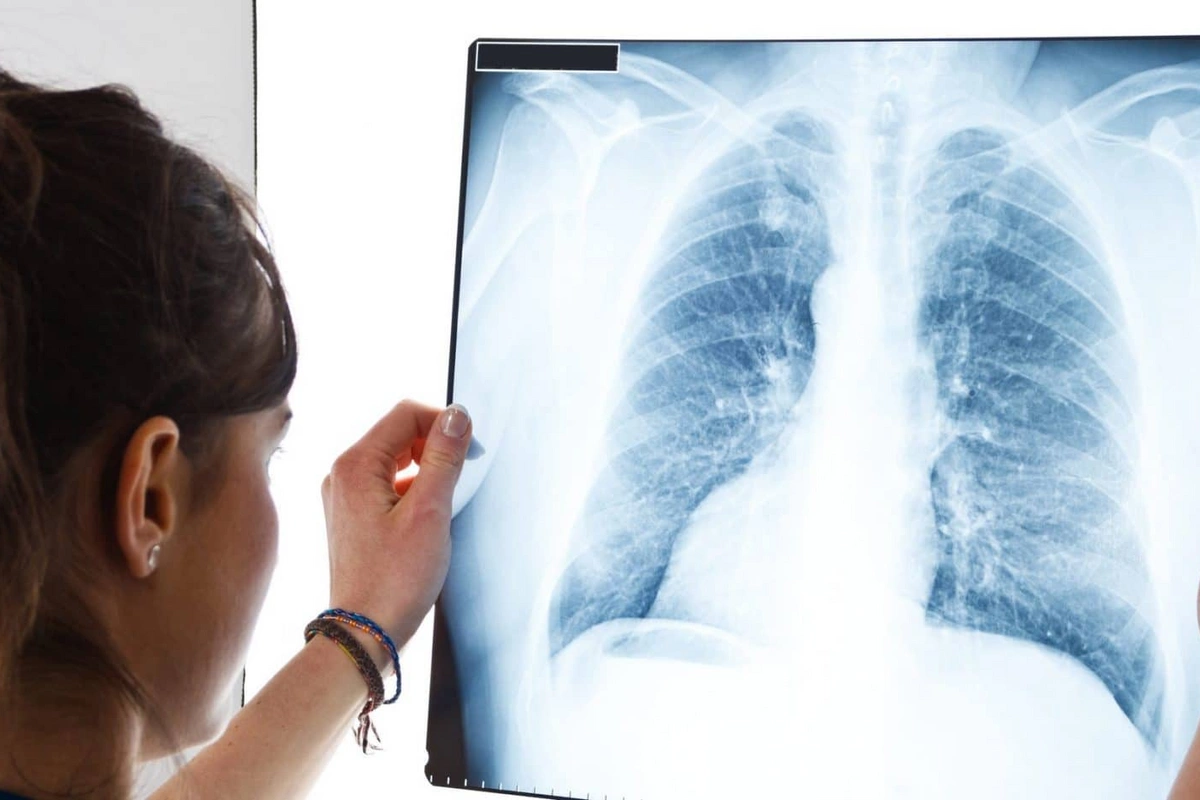 Депутат: Люди вынуждены ехать в Баку на рентген