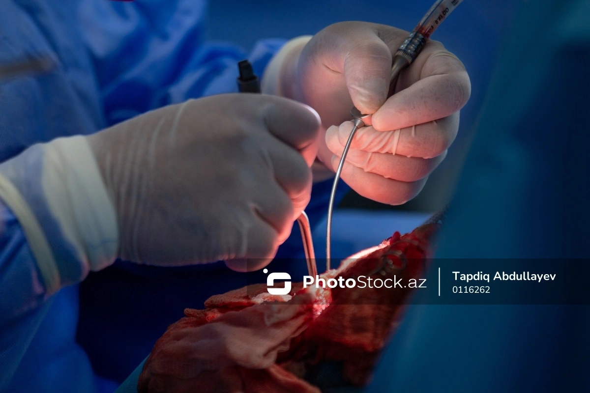 В следующем году в Азербайджане некоторые операции и лекарства станут бесплатными