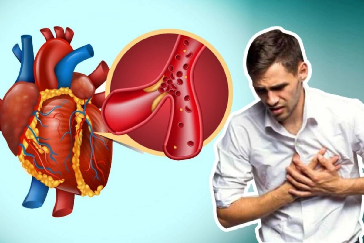 Men explained the reasons for the increased risk of cardiac arrest Men explained the reasons for the increased risk of cardiac arrest