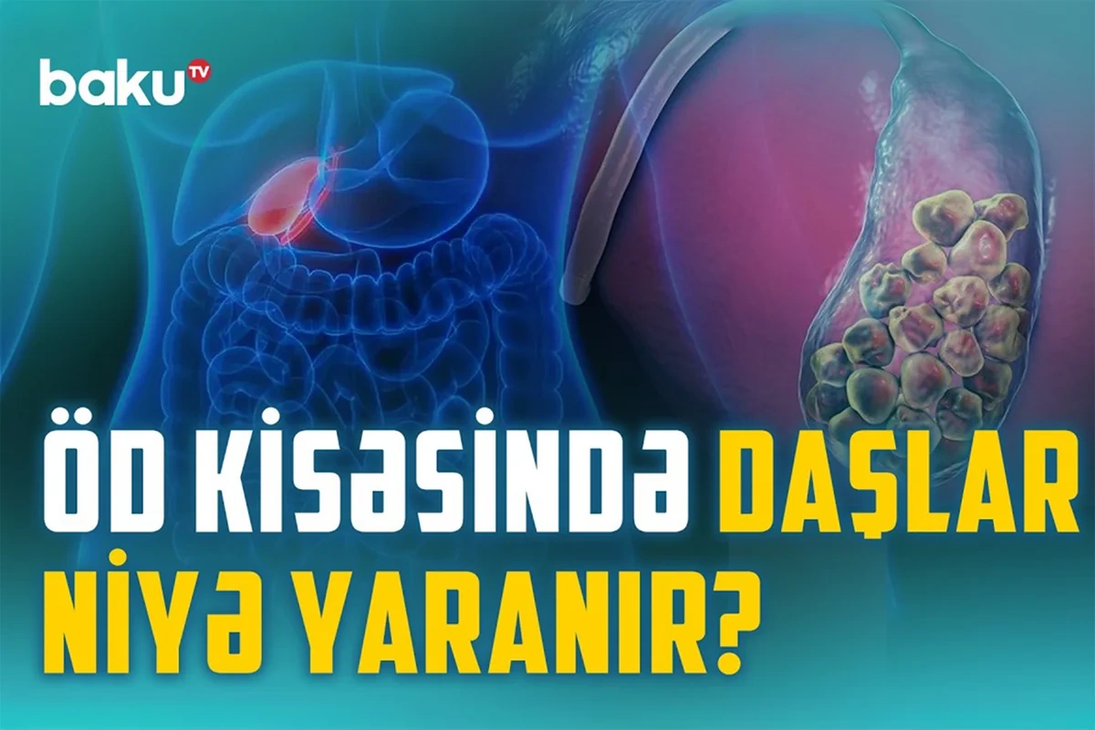 Öd və qaraciyər xəstəlikləri: Əməliyyat hansı halda şərtdir?