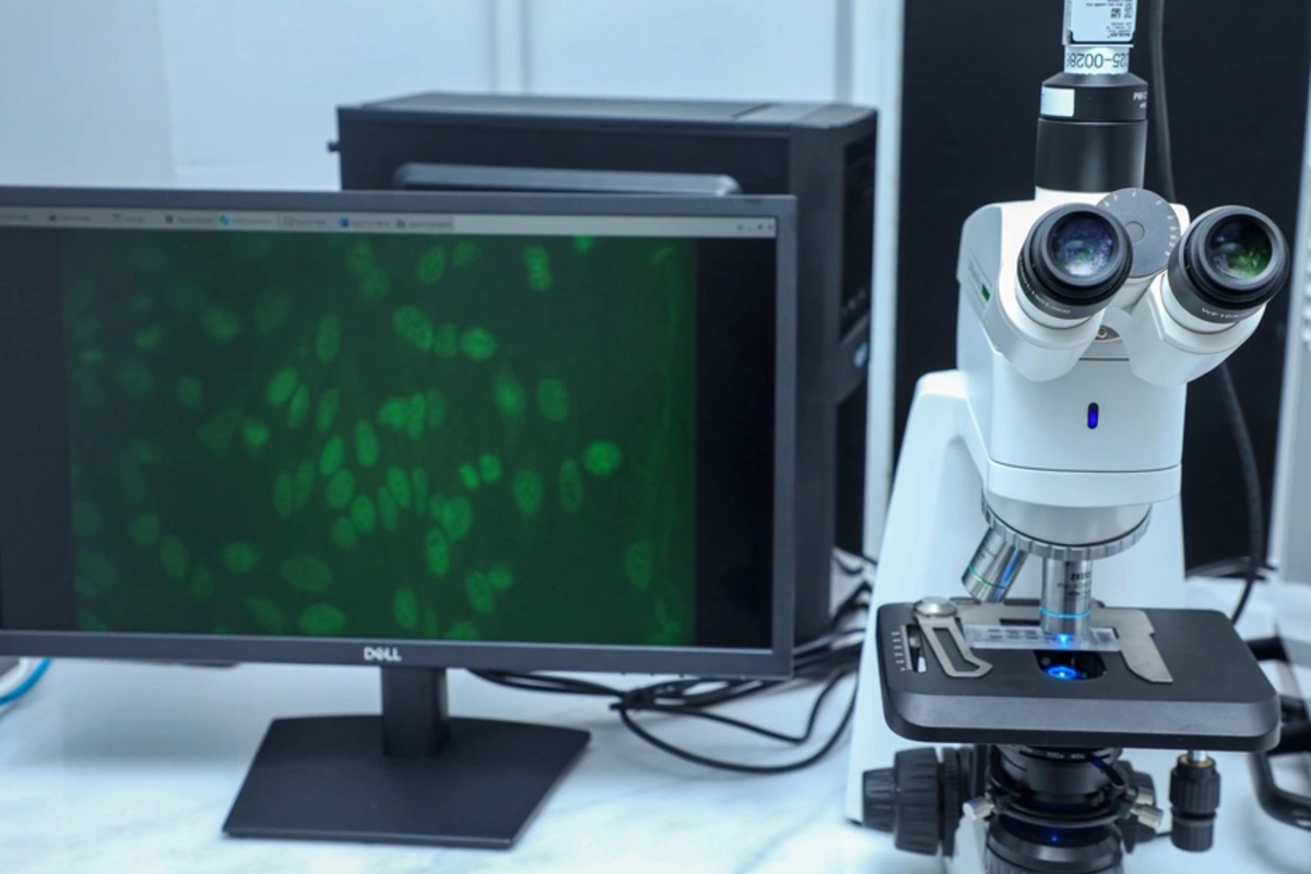 Mərkəzi Neftçilər Xəstəxanasında yeni autoimmun laboratoriyası istifadəyə verilib