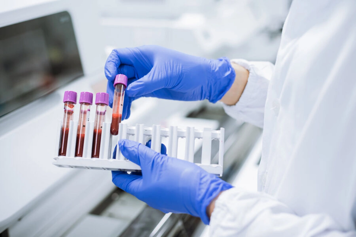 Doctors in India identified a new blood group in a patient Doctors in India identified a new blood group in a patient