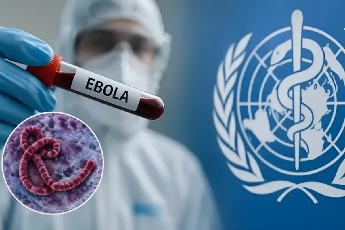 Ebola tarixdə görünməmiş sürətlə yayılır: ÜST-dən HƏYƏCAN TƏBİLİ