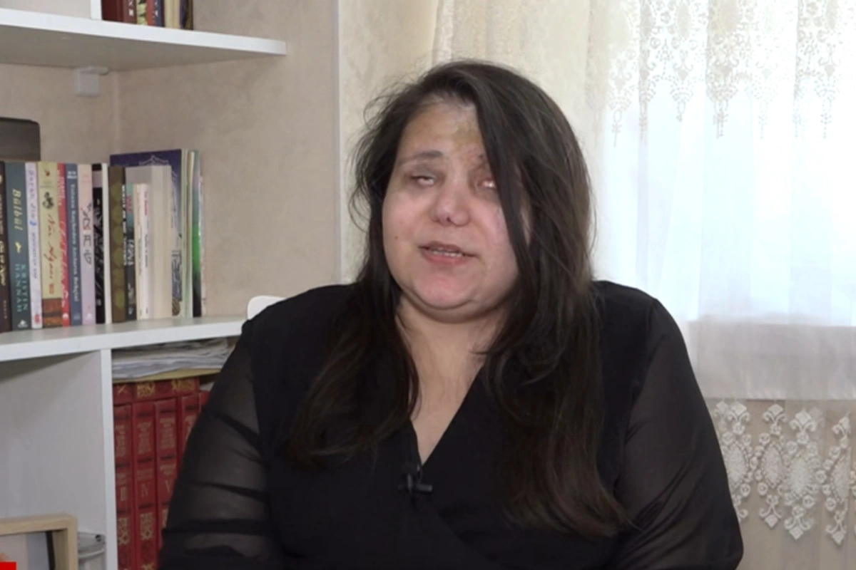 Gəncə terrorunda gözlərini itirən qadın başına gələnləri danışdı: Qoymayın ölüm, qızlarım var