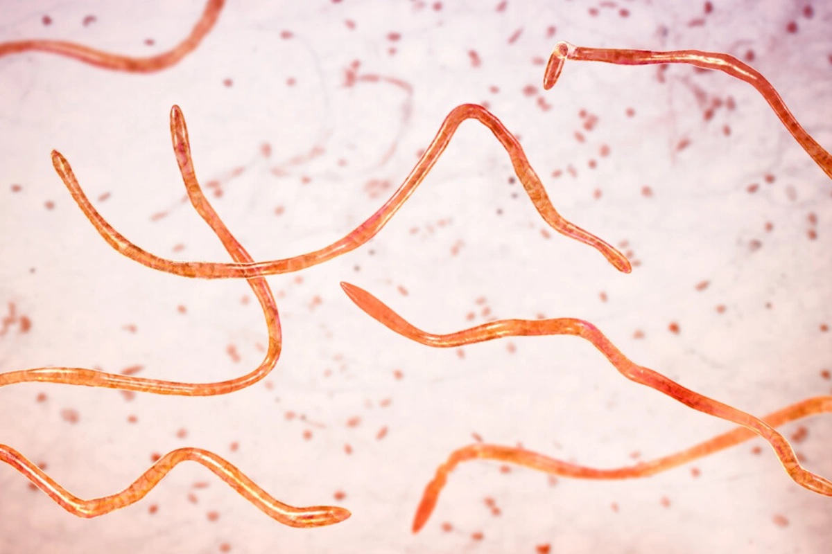 52 yaşlı supermodel bədənini qurd və parazitlərdən təmizlətdiyini ETİRAF ETDİ