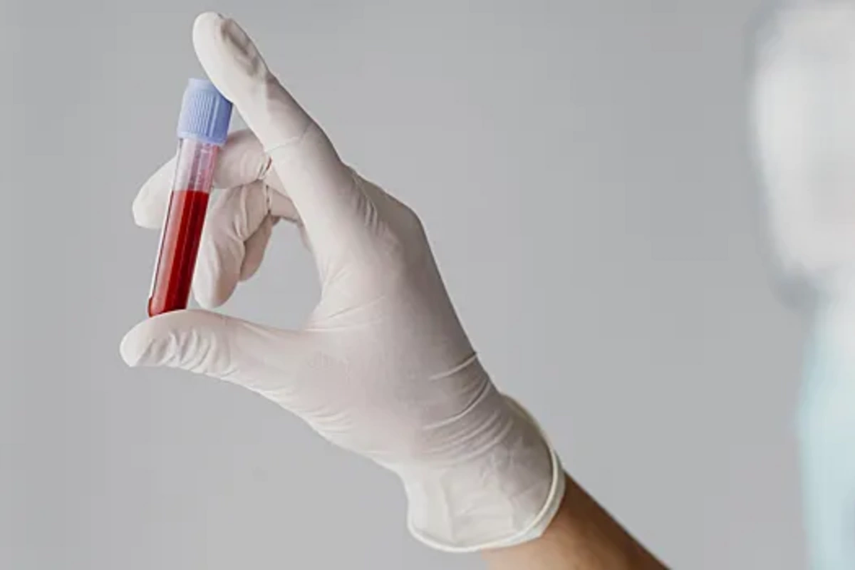 Всего один анализ, покажет, всё ли в порядке с щитовидкой в 50+