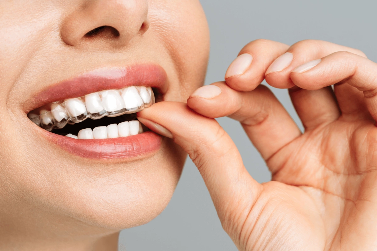 Ученые рассказали, как защитить зубы от сладкого