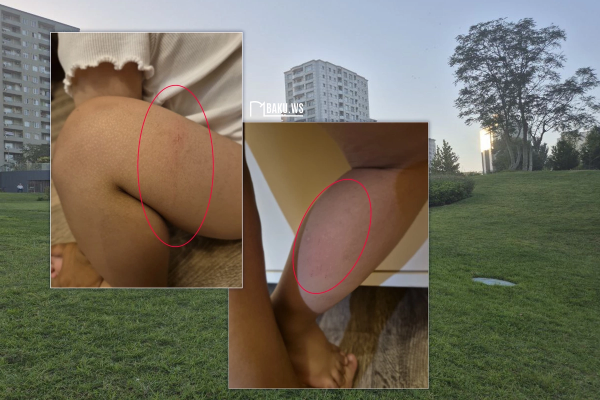 Mərkəzi Parkda 2 yaşlı uşaq kanalizasiya quyusuna düşdü Mərkəzi Parkda 2 yaşlı uşaq kanalizasiya quyusuna düşdü
