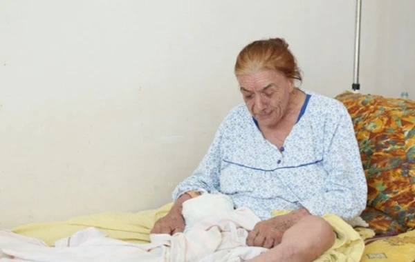 Ayağı səhv kəsilən xəstənin həkimi: "Bu, bizim işimiz deyil"