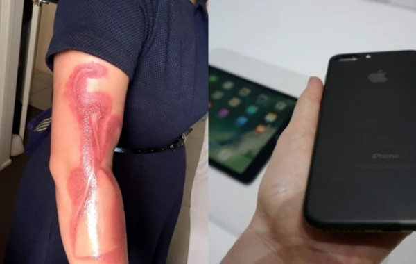 "iPhone 7" hamilə qadının qolunu bu hala saldı (FOTO)