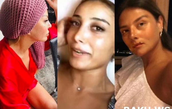 Məşhurlarımızın makiyajsız halı - TOP 10