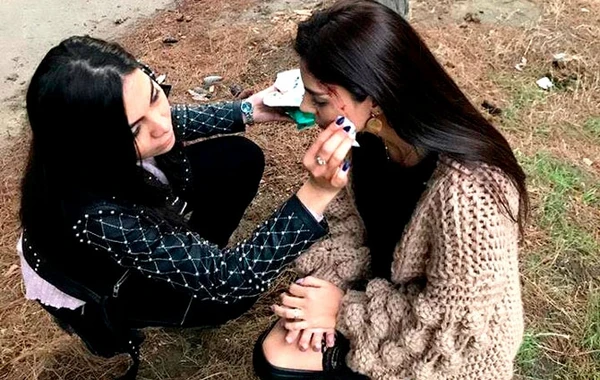 Natavanın çəkilişdə başı yarıldı - FOTO