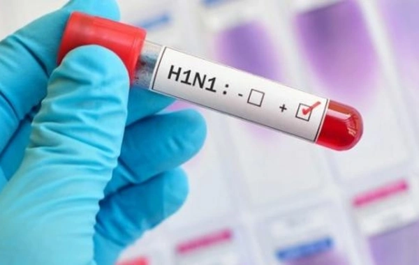 Təhlükəli A/H1 N1 qrip virusundan necə qorunmalıyıq? (VİDEO)