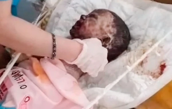 Əsəbləri zəif olanlar baxmasın! -  Gəncədə 2 yaşlı uşağa qarşı VƏHŞİLİK - VİDEO