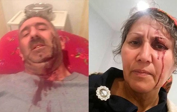 Qaçırılan qızın yaxınları oğlanın ata-anasını bıçaqladılar - FOTO