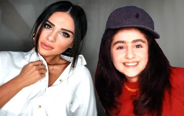 Qaşlarını aldırdı, dodağını şişirtdi - türk mediası Güneldən yazır... (FOTOLAR)