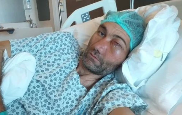 Üzü tanınmaz hala düşən fəhlə Türkiyəyə aparıldı