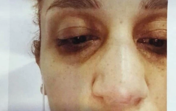 Bakıda anaya lesbi adı qoyub uşaqlarından ayırdılar - FOTO