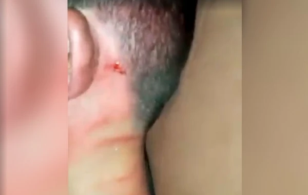 Azərbaycanda ata öz oğlunu vəhşicəsinə döydü - 18+ GÖRÜNTÜLƏR - VİDEO