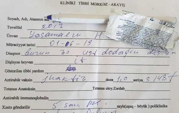 Novxanıda "Diana" restoranında it uşağın dodağını parçalayıb - FOTO