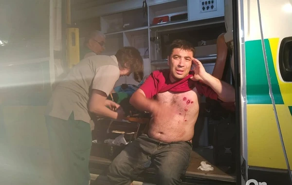 Полиция Грузии в упор расстреляла демонстрантов резиновыми пулями - ВИДЕО 18+