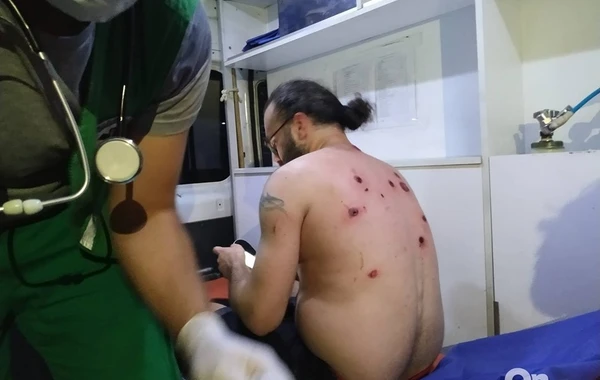 Полиция Грузии в упор расстреляла демонстрантов резиновыми пулями - ВИДЕО 18+