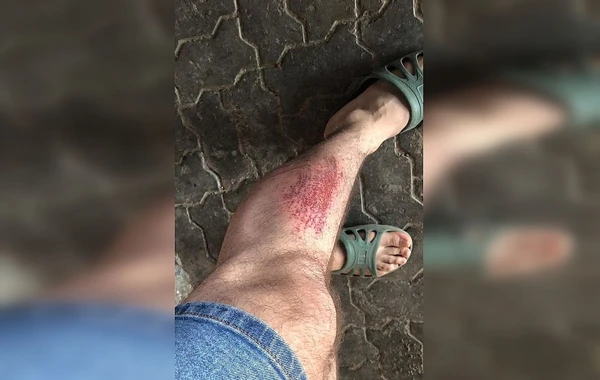 В России зверски избили азербайджанца и его девушку из-за национальной ненависти - ФОТО