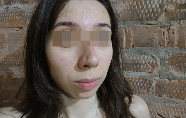 В России зверски избили азербайджанца и его девушку из-за национальной ненависти - ФОТО