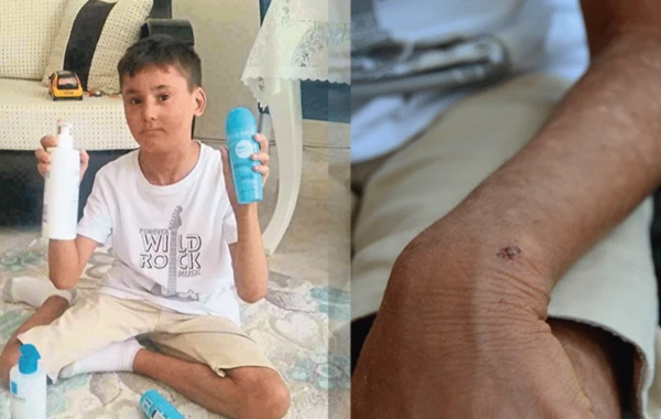 Azərbaycanlılar nadir xəstəliyə tutulan türk uşağın anasını sevindirdilər - VİDEO