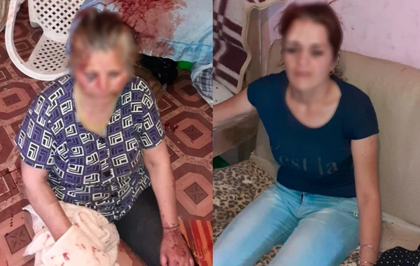 Bakıda qaynanasını döyən kürəkəndən YENİ XƏBƏR