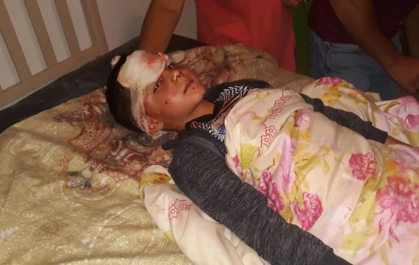 Tovuzda 6 yaşlı uşağı it dişləyib - FOTO