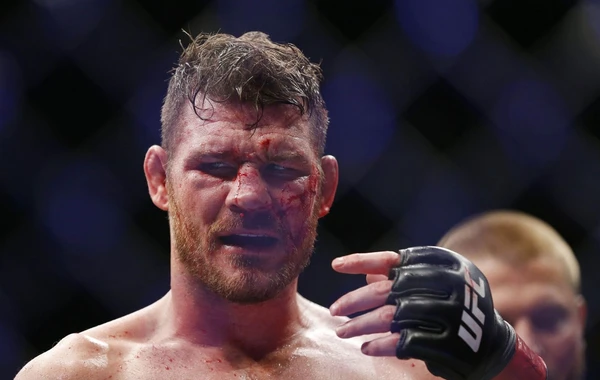 UFC çempionu canlı yayımda göz protezini çıxardı - VİDEO