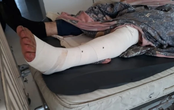 Qonaq getdiyi evdə ilan sancdı - FOTO