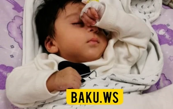Bakıda ürəyi sağda olan körpə doğuldu: Köməyə ehtiyacı var - FOTO