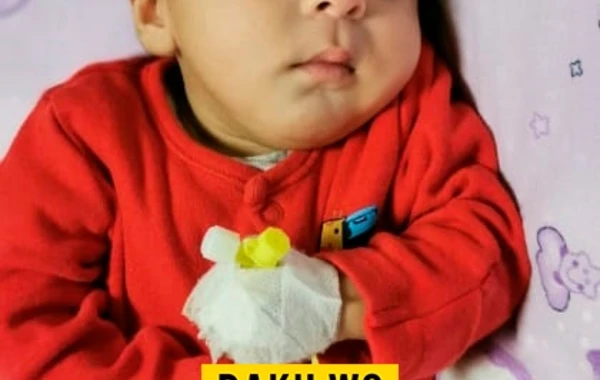 Bakıda ürəyi sağda olan körpə doğuldu: Köməyə ehtiyacı var - FOTO