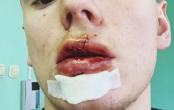 Сын певицы Валерии попал в страшное ДТП - ВИДЕО