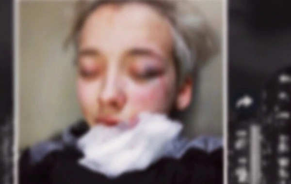 В России 7 мужчин жестоко избили 18-летнюю девушку из-за внешнего вида - ФОТО