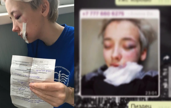 В России 7 мужчин жестоко избили 18-летнюю девушку из-за внешнего вида - ФОТО