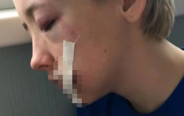 В России 7 мужчин жестоко избили 18-летнюю девушку из-за внешнего вида - ФОТО