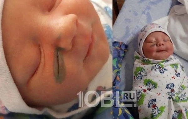 "Не надо было дергаться". В российском роддоме младенцу порезали лицо - ФОТО