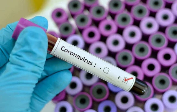Gürcüstanda koronavirusa yoluxan azərbaycanlının vəziyyəti açıqlandı