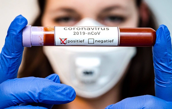 Naxçıvanda 71 nəfərdə koronavirus aşkarlanıb