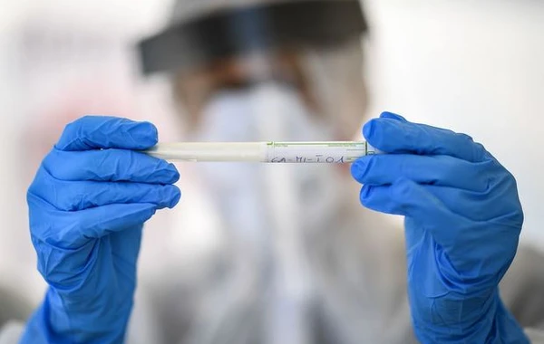 Azərbaycanda nazirliyin 15 əməkdaşında koronavirus aşkarlandı - RƏSMİ AÇIQLAMA