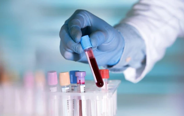 Azərbaycanda SARS virusuna görə testlər aparılacaq