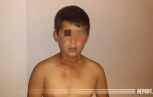 Bakıda DƏHŞƏT - Ata dilənmək istəməyən 11 yaşlı oğlunu başından bıçaqladı - FOTO