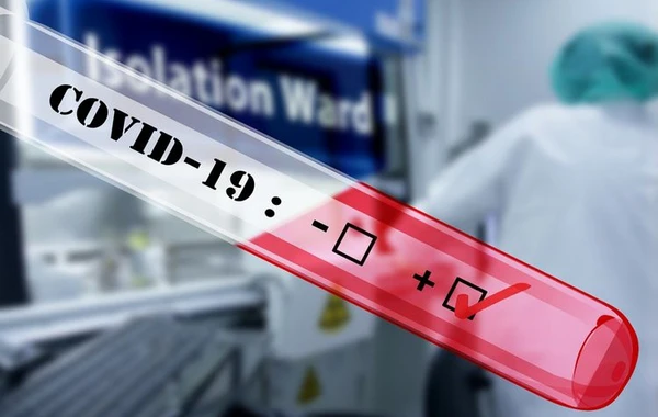 Azərbaycanda daha 191 nəfərdə koronavirus aşkarlandı